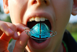 photo of boy with retainer appliance